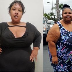 Akeso Occupational Health - Before injury (left)  After injury (right)