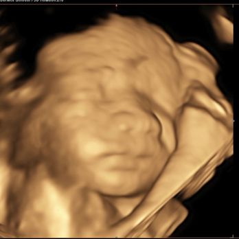 Womb's View - Baby boy! - Ultrasound Imaging Centers Near Me - Modesto, California Womb's View - Baby boy! - Ultrasound Imaging Centers Near Me - Modesto, California