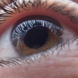 Miramar Eye Center