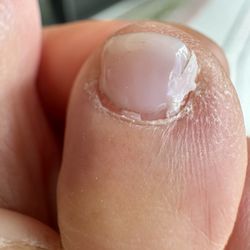 Pro Nails & Spa - 5 day old pedicure. Gel Polish lifting off the nail.