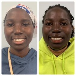 Atlantis Dental - Beautiful smile, transformation