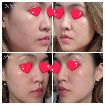 Yorkville Day Spa - Skin Care Near Me - New York, New York Yorkville Day Spa - Skin Care Near Me - New York, New York
