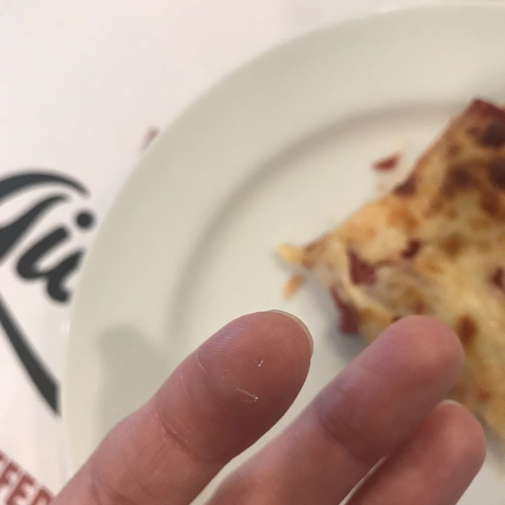 Giordano's - Pizza, hand with the glass shards on my finger - Pizza Near Me - St. Charles, Illinois