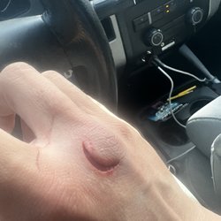 Kaiser San Jose Urgent Care - Good size cut , but nothing crazy