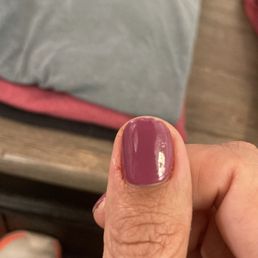 Inflamed/painful cuticle Inflamed/painful cuticle