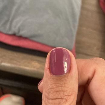 Rose Nails - Inflamed/painful cuticle - Nail Salons Near Me - Merced, California Rose Nails - Inflamed/painful cuticle - Nail Salons Near Me - Merced, California