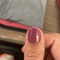 Rose Nails - Inflamed/painful cuticle