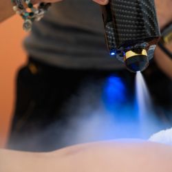 RISE Modern Wellness - Shape your body with our advanced fat-freezing treatments!