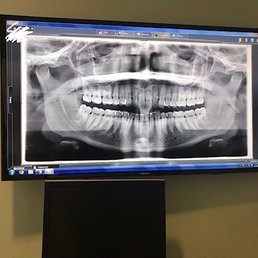 Serene Dental Team showed me the photos taken of my teeth and explained what they saw. So Cool! Serene Dental Team showed me the photos taken of my teeth and explained what they saw. So Cool!