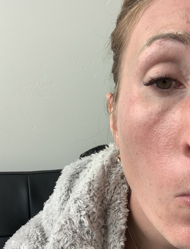 Aspen Dermatology Image