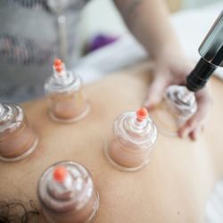 Prime Acupuncture