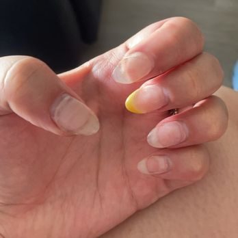 Nails Lux - Chipped nails after only a week and a few days - Nail Salons Near Me - Naperville, Illinois Nails Lux - Chipped nails after only a week and a few days - Nail Salons Near Me - Naperville, Illinois