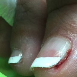 This is pro nail at 3152 Richmond road. The male tech dug and cut too deep into the side of the nail. So disappointing.