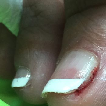 Pro Nail - This is pro nail at 3152 Richmond road. The male tech dug and cut too deep into the side of the nail. So disappointing. - Nail Salons Near Me - Lexington, Kentucky