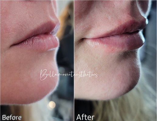 Bella Monet' Aesthetics