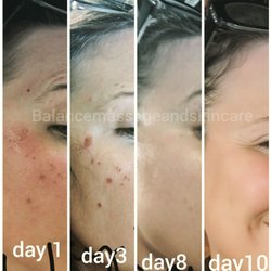Balance Massage and Skin Care by Melissa Stutzman