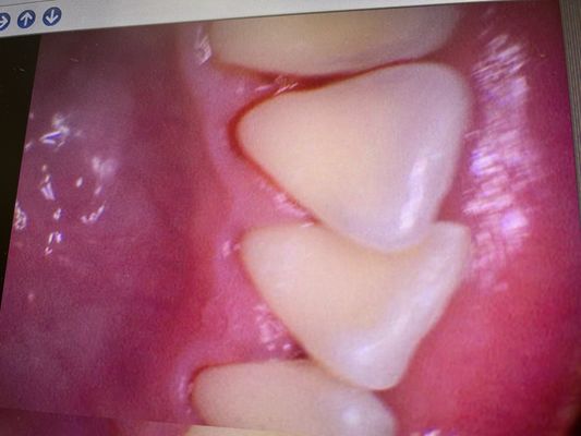 123 Dental on Yelp