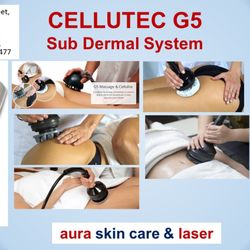 Aura Skin Care & Laser Services - Cellutec G5 at aura skin care laser burnaby Bc