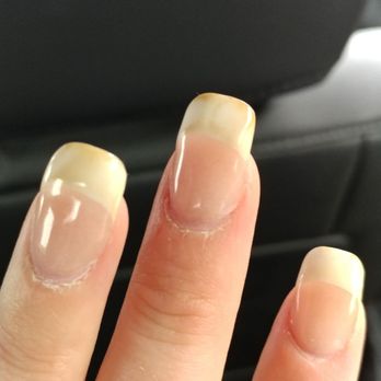 Angel Nails - Terribly yellowed French manicure 3 days after I got it, it looks like a used cigarette filter and I am not a smoker - Nail Salons Near Me - Raymond, Maine Angel Nails - Terribly yellowed French manicure 3 days after I got it, it looks like a used cigarette filter and I am not a smoker - Nail Salons Near Me - Raymond, Maine