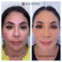 Skin Perfect Medical Aesthetics - West Hollywood