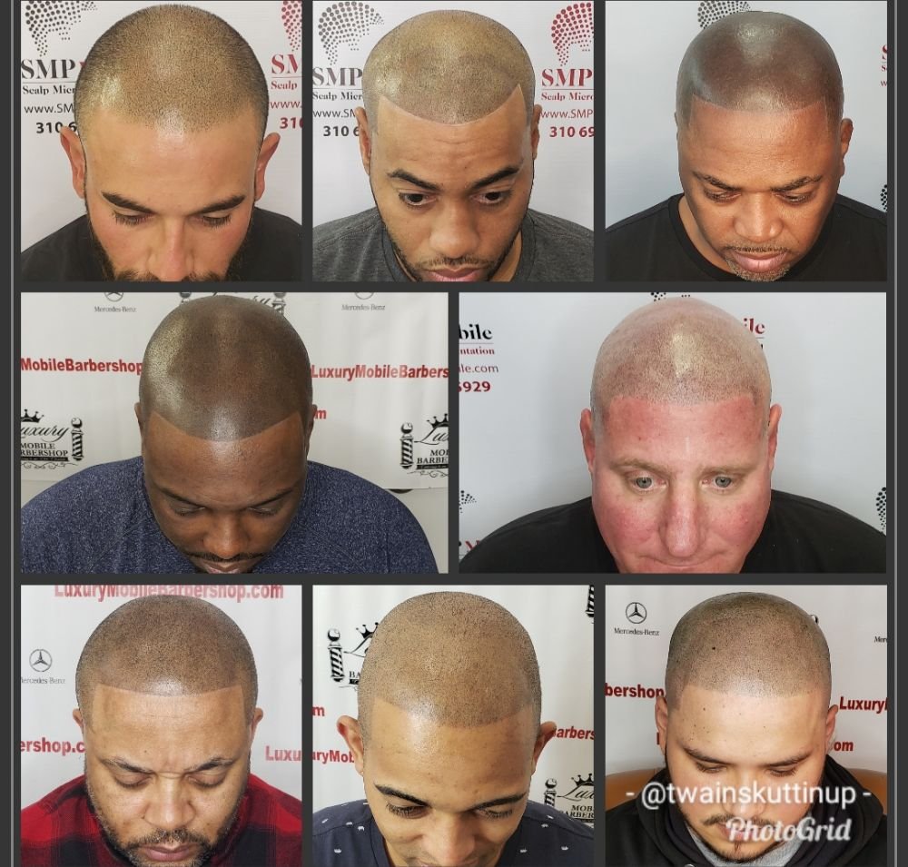 SMP Mobile Scalp Micropigmentation Logo