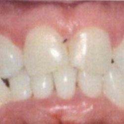 Norma Gomez, DDS - This is my original front teeth