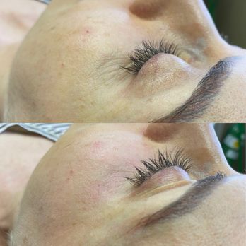 Stark Aesthetics - Medical Spas Near Me - Beverly Hills, California