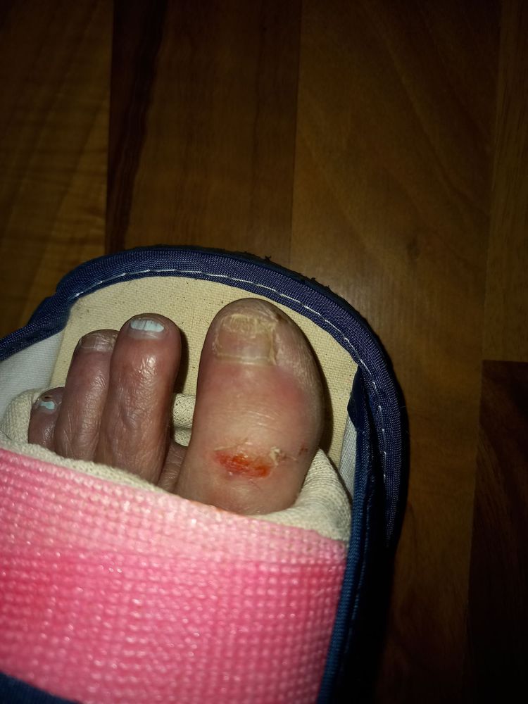 PODIATRY ASSOCIATES OF INDIANA FOOT AND ANKLE INSTITUTE Updated