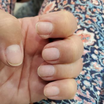 Awesome Nails & Wax - Before gel (French) - Nail Salons Near Me - Olathe, Kansas