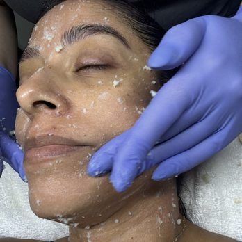 Best Face Forward Skincareapy - Icy part of the facial - Skin Care Near Me - La Mirada, California Best Face Forward Skincareapy - Icy part of the facial - Skin Care Near Me - La Mirada, California