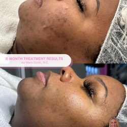 Mary Scott Skincare - Witnessing results like her's come to life are the reason we do what we do. We absolutely love making all your skin dreams come true