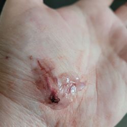 Surepoint Emergency Center Addison - Yuck