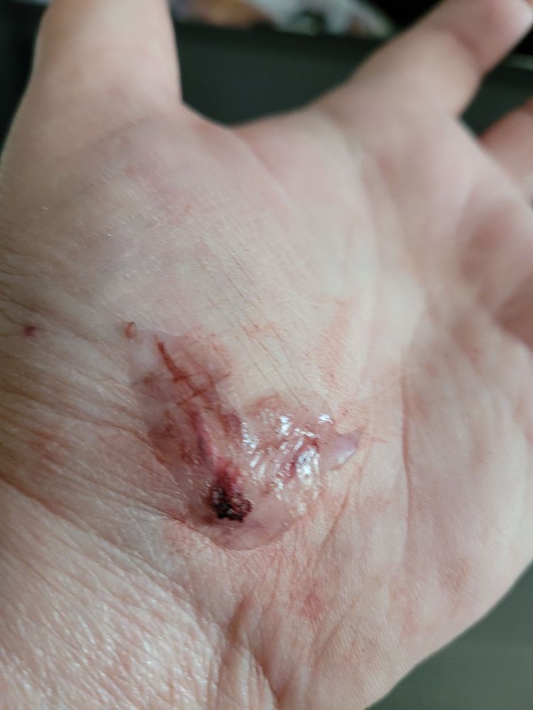 Surepoint Emergency Center Addison - patient advocate in Dallas, TX