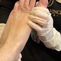 Ow!