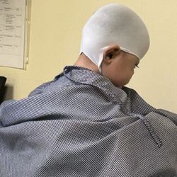 Align Clinic - Scanning the head for analysis