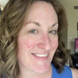 NWME Aesthetics - Before any treatments