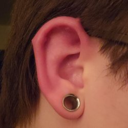 Tried And Tru Body Art - Irritation bumps due to incorrect placement and bar sizing.