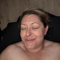 Graceful Touch Esthetics - Before facial