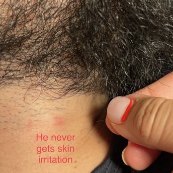 HD Barber Studio - Skin irritation and missed long stray neck hairs - Barbers Near Me - Santa Rosa, California HD Barber Studio - Skin irritation and missed long stray neck hairs - Barbers Near Me - Santa Rosa, California