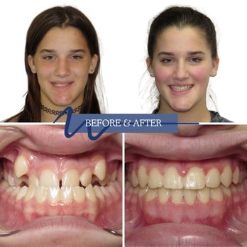 Williamsburg Orthodontics - Orthodontists Near Me - Williamsburg, Virginia Williamsburg Orthodontics - Orthodontists Near Me - Williamsburg, Virginia