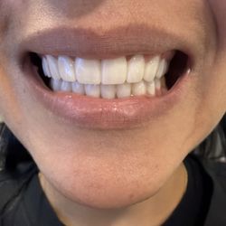 Limitless Dental Jersey City - Design smile