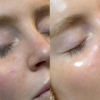 Succulent Skin by Kim - Skin Care Near Me - Bartlett, Illinois Succulent Skin by Kim - Skin Care Near Me - Bartlett, Illinois