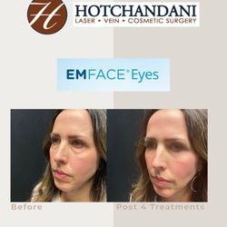 Hotchandani Laser Aesthetic Center