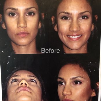 Raj Kanodia Plastic Surgery - Plastic Surgeons Near Me - Beverly Hills, California Raj Kanodia Plastic Surgery - Plastic Surgeons Near Me - Beverly Hills, California