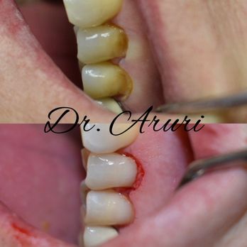 North Haven Dentists - Pediatric Dentists Near Me - North Haven, Connecticut North Haven Dentists - Pediatric Dentists Near Me - North Haven, Connecticut