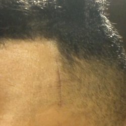 Right side cut.