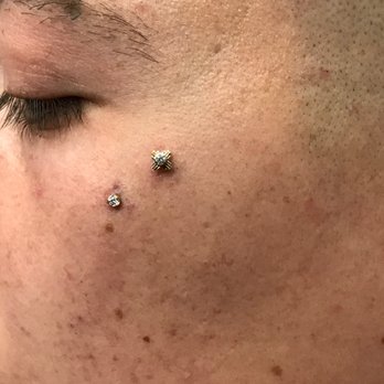 Ascension Body Modification - Microdermal anchors with Gold Zia symbol by Steve Truitt @steve_truitt - Tattoo Near Me - Albuquerque, New Mexico Ascension Body Modification - Microdermal anchors with Gold Zia symbol by Steve Truitt @steve_truitt - Tattoo Near Me - Albuquerque, New Mexico