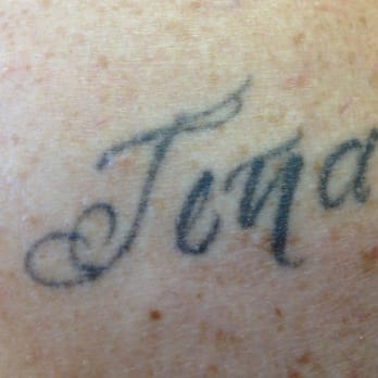 MD Tattoo Studio - Before MD Tattoo. - Tattoo Near Me - Thousand Oaks, California MD Tattoo Studio - Before MD Tattoo. - Tattoo Near Me - Thousand Oaks, California