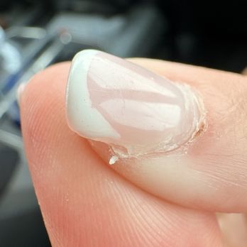 Sunset Spa Nails - Acrylic lifting and my nail showing - Nail Salons Near Me - Marathon, Florida Sunset Spa Nails - Acrylic lifting and my nail showing - Nail Salons Near Me - Marathon, Florida