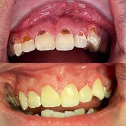 Salem Family Dental Care